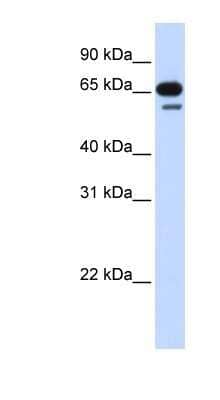 Western Blot: R3HDM2 Antibody [NBP1-56775] - 293T cells lysate, concentration 0.2-1 ug/ml.
