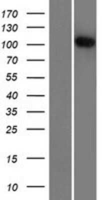 Western Blot: R3HDM2 Overexpression Lysate (Adult Normal) [NBP2-07247] Left-Empty vector transfected control cell lysate (HEK293 cell lysate); Right -Over-expression Lysate for R3HDM2.