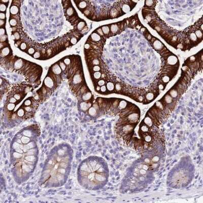 Immunohistochemistry: R3HDM4 Antibody [NBP2-37924] - Staining of human small intestine shows cytoplasmic positivity in glandular cells.