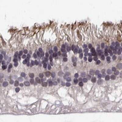 Immunohistochemistry-Paraffin: R9AP Antibody [NBP2-48946] - Staining of human retina shows strong cytoplasmic positivity in rods.