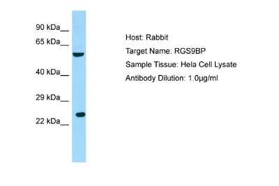 Western Blot: R9AP Antibody [NBP1-98304] - Antibody Dilution: 1.0ug/ml Sample Tissue: Hela cell lysate.