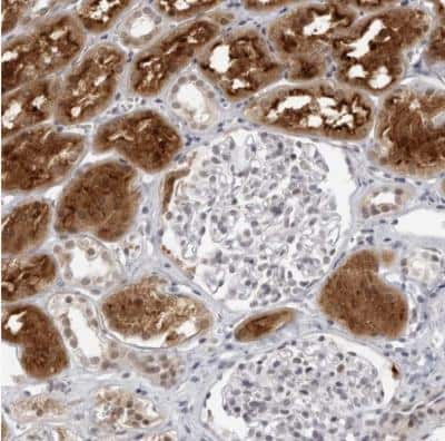 Immunohistochemistry-Paraffin: RAB11FIP3 Antibody [NBP1-83999] -  Staining of human kidney shows strong cytoplasmic and membrane positivity in renal tubules