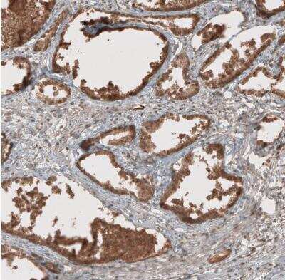 Immunohistochemistry-Paraffin: RAB11FIP3 Antibody [NBP1-84000] -  Staining of human prostate shows moderate to strong cytoplasmic positivity in glandular cells.