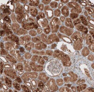 Immunohistochemistry-Paraffin: RAB11FIP3 Antibody [NBP1-84000] -  Staining of human kidney shows moderate to strong cytoplasmic positivity in cells in tubules