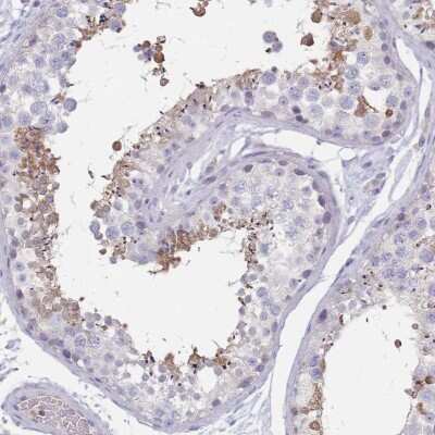 Immunohistochemistry-Paraffin RAB11FIP4 Antibody - BSA Free