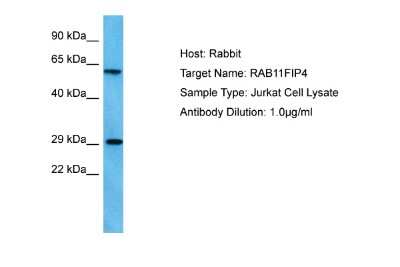 Western Blot: RAB11FIP4 Antibody [NBP2-85570] - Host: Rabbit. Target Name: RAB11FIP4. Sample Tissue: Human Jurkat Whole Cell lysates. Antibody Dilution: 1ug/ml