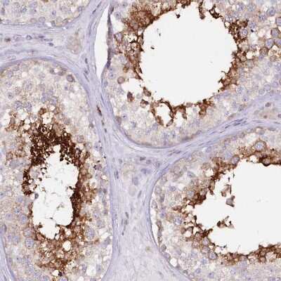 Immunohistochemistry-Paraffin: RAB11FIP5 Antibody [NBP2-32662] - Staining of human testis shows high expression.