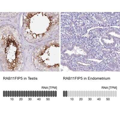 Immunohistochemistry-Paraffin RAB11FIP5 Antibody