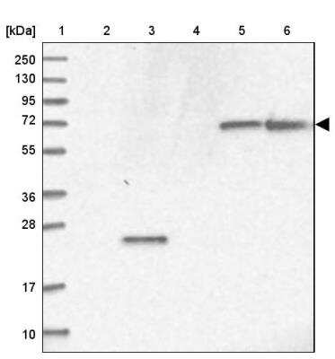 Western Blot: RAB11FIP5 Antibody [NBP1-81855] - Lane 1: Marker  [kDa] 250, 130, 95, 72, 55, 36, 28, 17, 10.  Lane 2: Human cell line RT-4.  Lane 3: Human cell line U-251MG sp.  Lane 4: Human plasma (IgG/HSA depleted).  Lane 5: Human liver tissue.  Lane 6: Human tonsil tissue