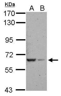 Western Blot RAB11FIP5 Antibody