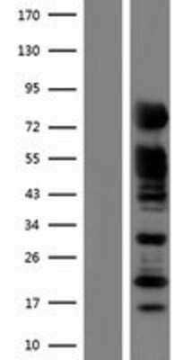 Western Blot RAB11FIP5 Overexpression Lysate