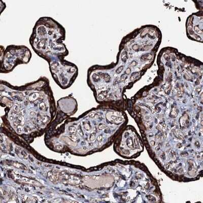 Immunohistochemistry-Paraffin: RAB12 Antibody [NBP1-90976] - Staining of human placenta shows very strong granular cytoplasmic positivity in trophoblastic cells.