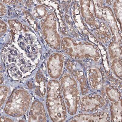 Immunohistochemistry-Paraffin: RAB12 Antibody [NBP1-90976] - Staining of human kidney shows moderate granular cytoplasmic positivity in cells in tubules.