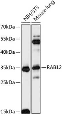 Western Blot: RAB12 Antibody [NBP2-93258] - Analysis of extracts of various cell lines, using RAB12 at 1:3000 dilution. Secondary antibody: HRP Goat Anti-Rabbit IgG (H+L) at 1:10000 dilution. Lysates/proteins: 25ug per lane. Blocking buffer: 3% nonfat dry milk in TBST. Detection: ECL Basic Kit . Exposure time: 60s.