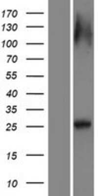 Western Blot: RAB12 Overexpression Lysate (Adult Normal) [NBP2-08632] Left-Empty vector transfected control cell lysate (HEK293 cell lysate); Right -Over-expression Lysate for RAB12.