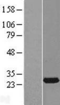 Western Blot RAB14 Overexpression Lysate