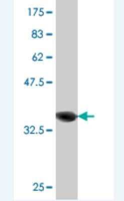 Western Blot: RAB21 Antibody (1G4) [H00023011-M03] - Detection against Immunogen (37.84 KDa)