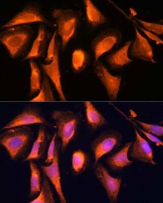 Immunocytochemistry/ Immunofluorescence RAB21 Antibody - Azide and BSA Free