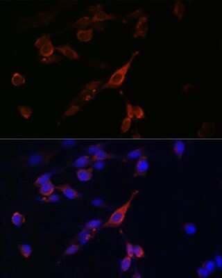 Immunocytochemistry/ Immunofluorescence RAB21 Antibody - Azide and BSA Free