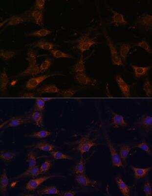 Immunocytochemistry/ Immunofluorescence RAB21 Antibody - Azide and BSA Free