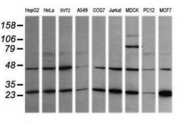 Western Blot: RAB21 Antibody (OTI6E12) - Azide and BSA Free [NBP2-73769] - Analysis of extracts (35ug) from 9 different cell lines (HepG2: human; HeLa: human; SVT2: mouse; A549: human; COS7: monkey; Jurkat: human; MDCK: canine; PC12: rat; MCF7: human).