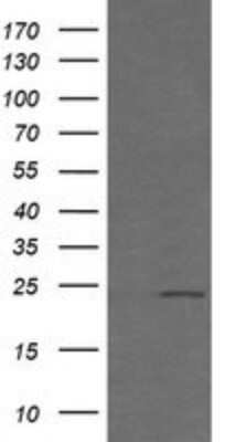 Western Blot: RAB21 Antibody (OTI6E12) - Azide and BSA Free [NBP2-73769] - Analysis of HEK293T cells were transfected with the pCMV6-ENTRY control (Left lane) or pCMV6-ENTRY RAB21.