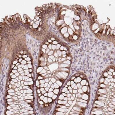 Immunohistochemistry: RAB22A Antibody [NBP2-39080] - Staining of human rectum shows strong cytoplasmic positivity in glandular cells.