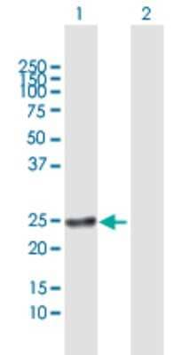 Western Blot: RAB22A Antibody [H00057403-B01P] - Analysis of RAB22A expression in transfected 293T cell line by RAB22A polyclonal antibody.  Lane 1: RAB22A transfected lysate(21.45 KDa). Lane 2: Non-transfected lysate.