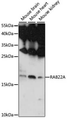 Western Blot: RAB22A Antibody [NBP2-93060] - Analysis of extracts of various cell lines, using RAB22A at 1:1000 dilution. Secondary antibody: HRP Goat Anti-Rabbit IgG (H+L) at 1:10000 dilution. Lysates/proteins: 25ug per lane. Blocking buffer: 3% nonfat dry milk in TBST. Detection: ECL Basic Kit . Exposure time: 90s.