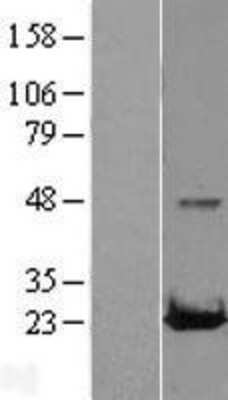 Western Blot: RAB22A Overexpression Lysate (Adult Normal) [NBL1-15048] Left-Empty vector transfected control cell lysate (HEK293 cell lysate); Right -Over-expression Lysate for RAB22A.