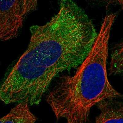 Immunocytochemistry/Immunofluorescence: RAB23 Antibody [NBP1-86366] - Staining of human cell line U-2 OS shows localization to plasma membrane, cytosol and centrosome.