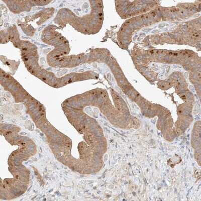 Immunohistochemistry-Paraffin: RAB23 Antibody [NBP1-86367] - Staining of human gallbladder shows moderate cytoplasmic positivity in glandular cells.