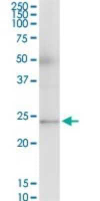 Western Blot: RAB23 Antibody [H00051715-B01P] - Analysis of RAB23 expression in human spleen.