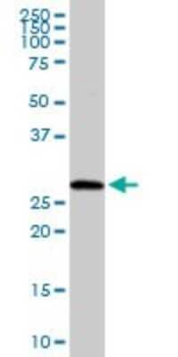 Western Blot: RAB23 Antibody [H00051715-D01P] - Analysis of RAB23 expression in human colon.