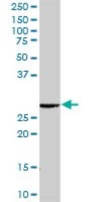 Western Blot: RAB23 Antibody [H00051715-D01P] - Analysis of RAB23 expression in mouse spleen.