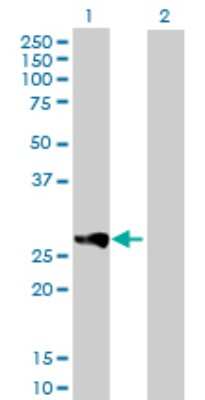 Western Blot: RAB23 Antibody [H00051715-D01P] - Analysis of RAB23 expression in transfected 293T cell line by RAB23 polyclonal antibody.Lane 1: RAB23 transfected lysate(26.70 KDa).Lane 2: Non-transfected lysate.