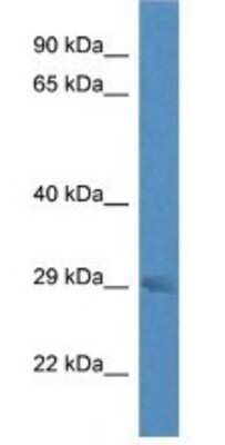 Western Blot: RAB23 Antibody [NBP1-79647] - Mouse Brain Lysate 1ug/ml  Gel Concentration 12%