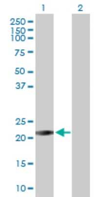 Western Blot: RAB26 Antibody [H00025837-D01P] - Analysis of RAB26 expression in transfected 293T cell line by RAB26 polyclonal antibody.Lane 1: RAB26 transfected lysate(20.90 KDa).Lane 2: Non-transfected lysate.