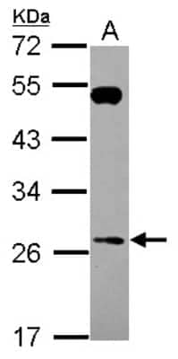 Western Blot RAB26 Antibody