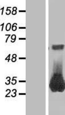 Western Blot RAB26 Overexpression Lysate