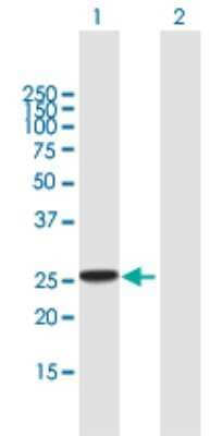 Western Blot: RAB27B Antibody [H00005874-B02P] - Analysis of RAB27B expression in transfected 293T cell line by RAB27B polyclonal antibody.  Lane 1: RAB27B transfected lysate(23.98 KDa). Lane 2: Non-transfected lysate.