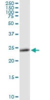 Western Blot: RAB27B Antibody [H00005874-D01P] - Analysis of RAB27B expression in HeLa.