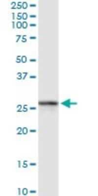 Western Blot: RAB27B Antibody [H00005874-D01P] - Analysis of RAB27B expression in human spleen.