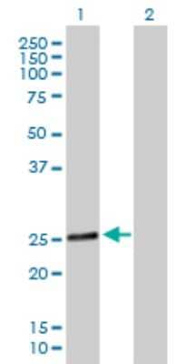 Western Blot: RAB28 Antibody [H00009364-B02P] - Analysis of RAB28 expression in transfected 293T cell line by RAB28 polyclonal antibody.  Lane 1: RAB28 transfected lysate(24.31 KDa). Lane 2: Non-transfected lysate.