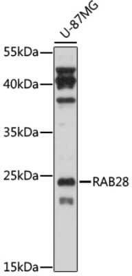 Western Blot: RAB28 Antibody [NBP3-05176] - Analysis of extracts of U-87MG cells, using RAB28 antibody at 1:1000 dilution. Secondary antibody: HRP Goat Anti-Rabbit IgG (H+L) at 1:10000 dilution. Lysates/proteins: 25ug per lane. Blocking buffer: 3% nonfat dry milk in TBST. Detection: ECL Enhanced Kit