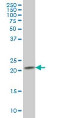 Western Blot: RAB2B Antibody (7E4) [H00084932-M02] - RAB2B monoclonal antibody (M02), clone 7E4. Analysis of RAB2B expression in Raw 264.7.