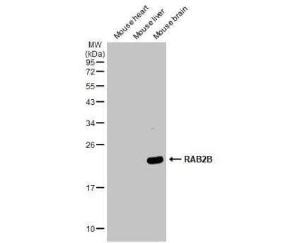 Western Blot: RAB2B Antibody [NBP1-31631] - Various tissue extracts (50 ug) were separated by 12% SDS-PAGE, and the membrane was blotted with RAB2B antibody diluted at 1:1000. The HRP-conjugated anti-rabbit IgG antibody (NBP2-19301) was used to detect the primary antibody.
