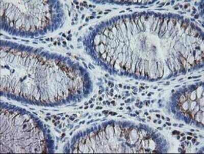 Immunohistochemistry: RAB30 Antibody (OTI3E7) - Azide and BSA Free [NBP2-73771] - Analysis of Human colon tissue. (Heat-induced epitope retrieval by 10mM citric buffer, pH6.0, 120C for 3min)