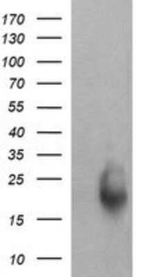 Western Blot: RAB30 Antibody (OTI3E7) - Azide and BSA Free [NBP2-73771] - Analysis of HEK293T cells were transfected with the pCMV6-ENTRY control (Left lane) or pCMV6-ENTRY RAB30.