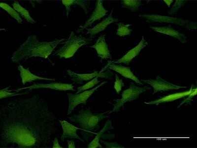 Immunocytochemistry/Immunofluorescence: RAB31 Antibody [H00011031-B01P] - Analysis of purified antibody to RAB31 on HeLa cell. (antibody concentration 10 ug/ml)